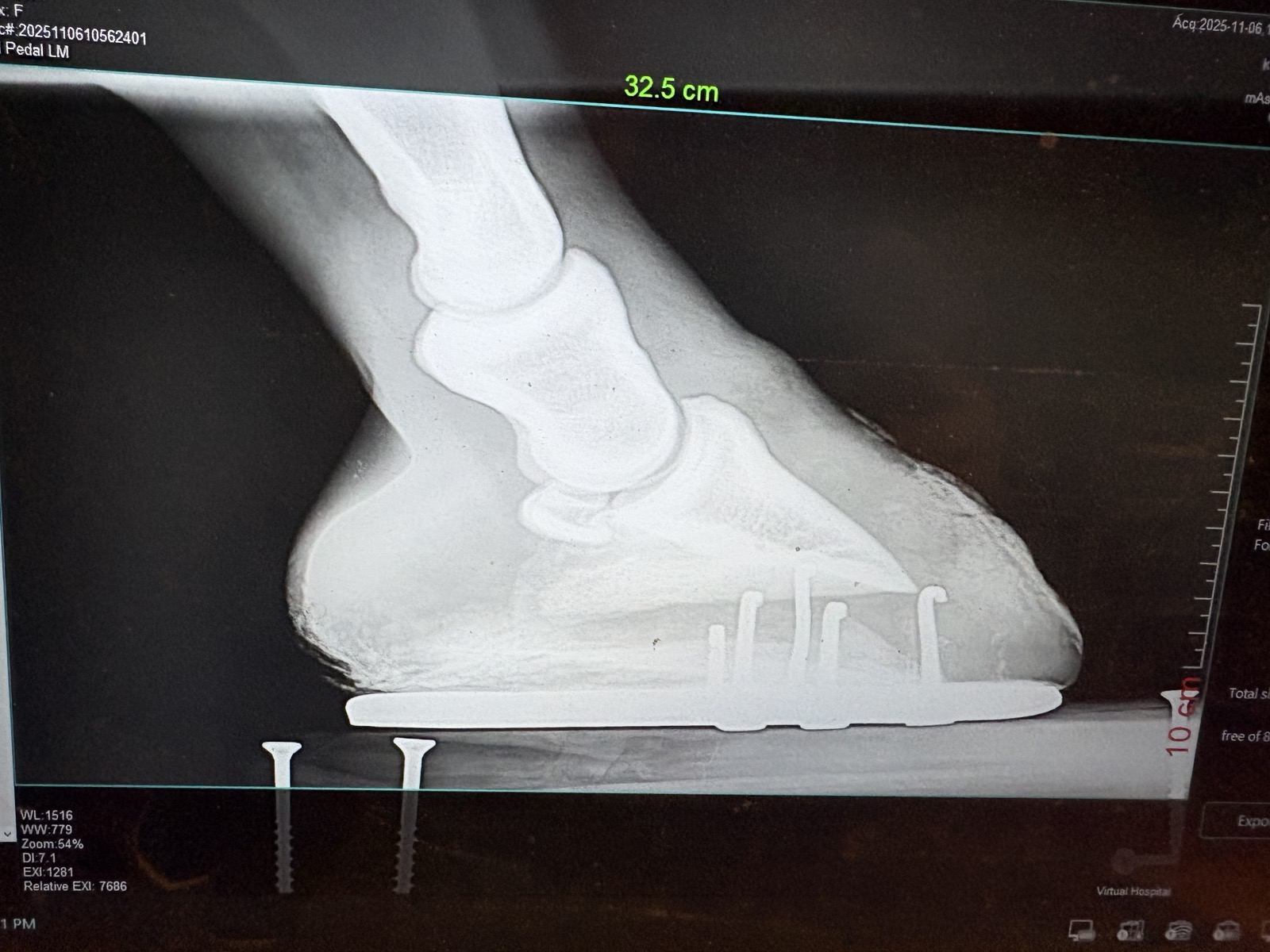 Lateral hoof radiograph before treatment